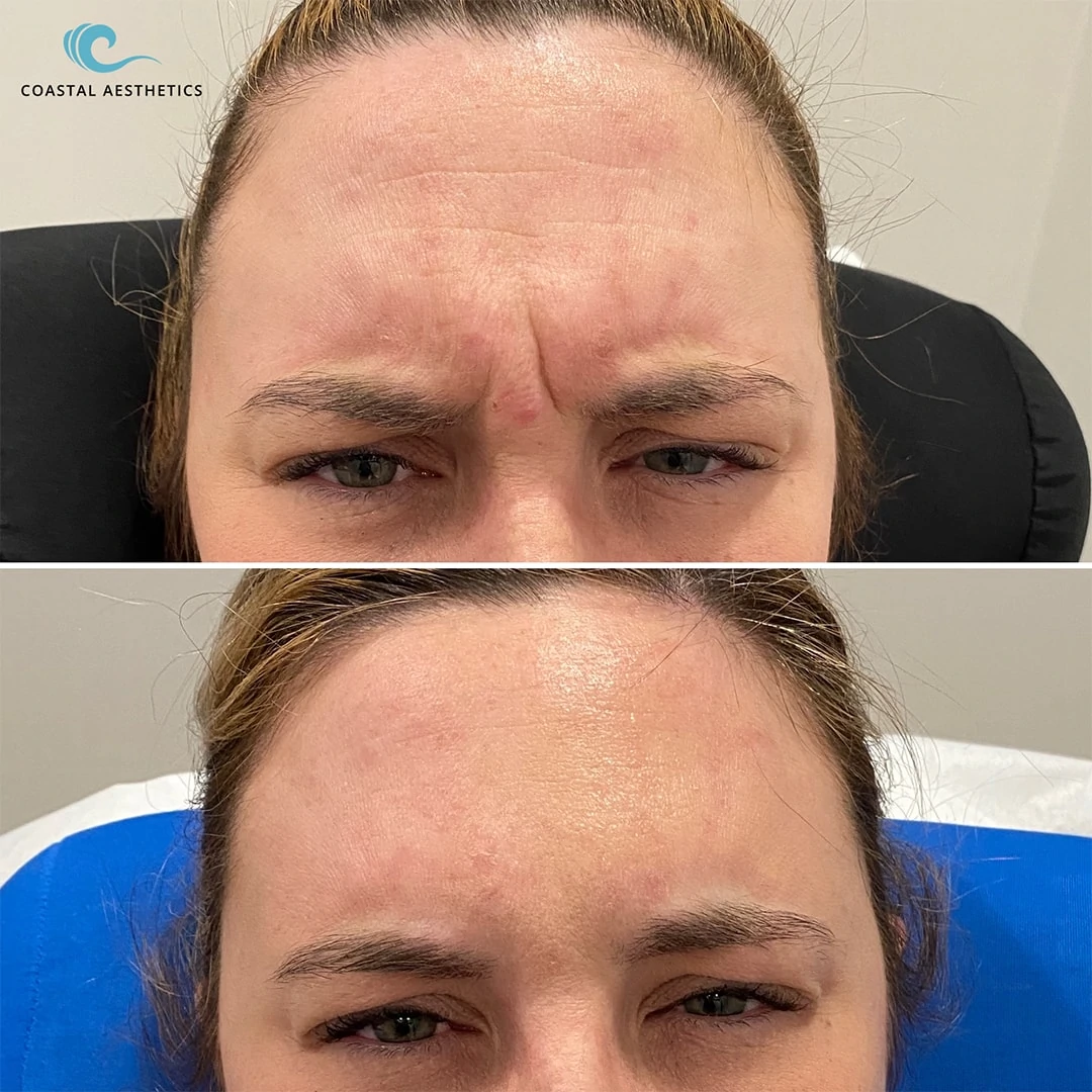 Before and After Photo Gallery