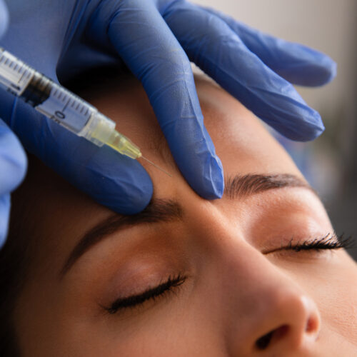 Corrective Botox + FREE Neck Lift Tox