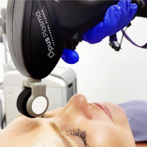 Opus Plasma 3 Treatment Series (Face + Neck)