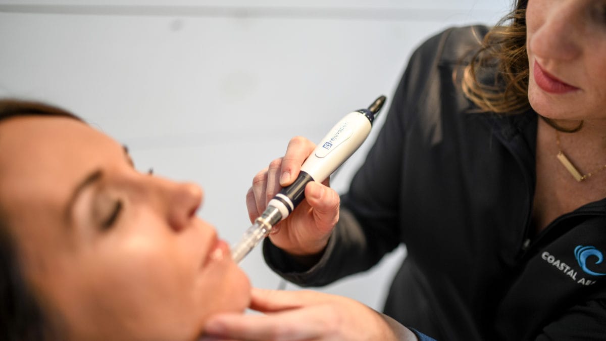 What is MicroNeedling? Medical Spa in York, Maine Coastal Aesthetics