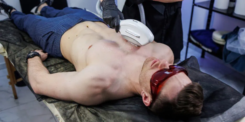 What to expect in Back and Chest Laser Hair Removal for Men (1)