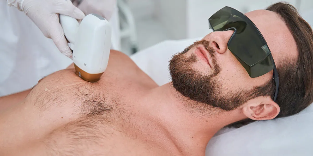 back and chest laser hair removal for men