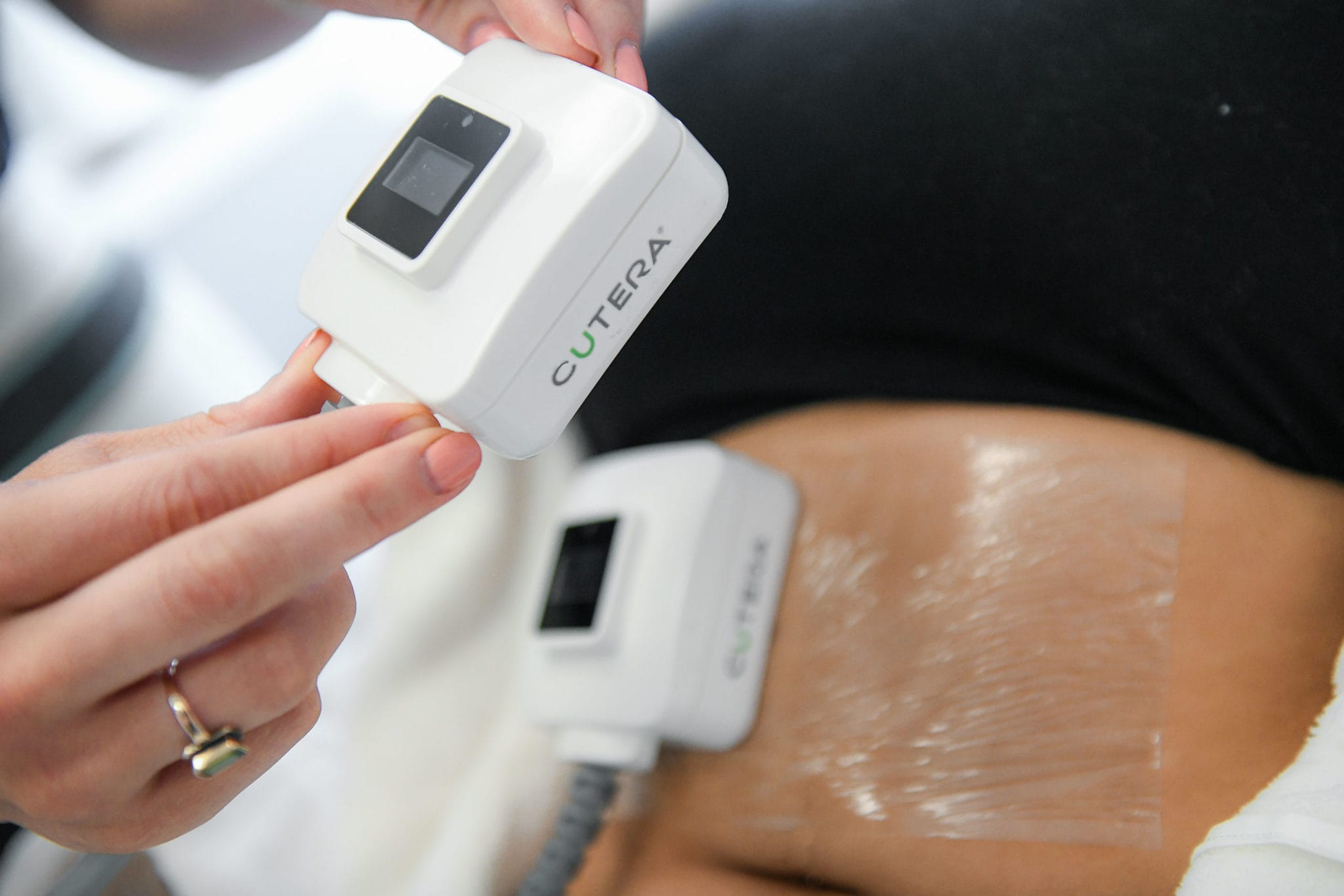 Trusculpt vs. Coolsculpting Body Sculpting Coastal Aesthetics