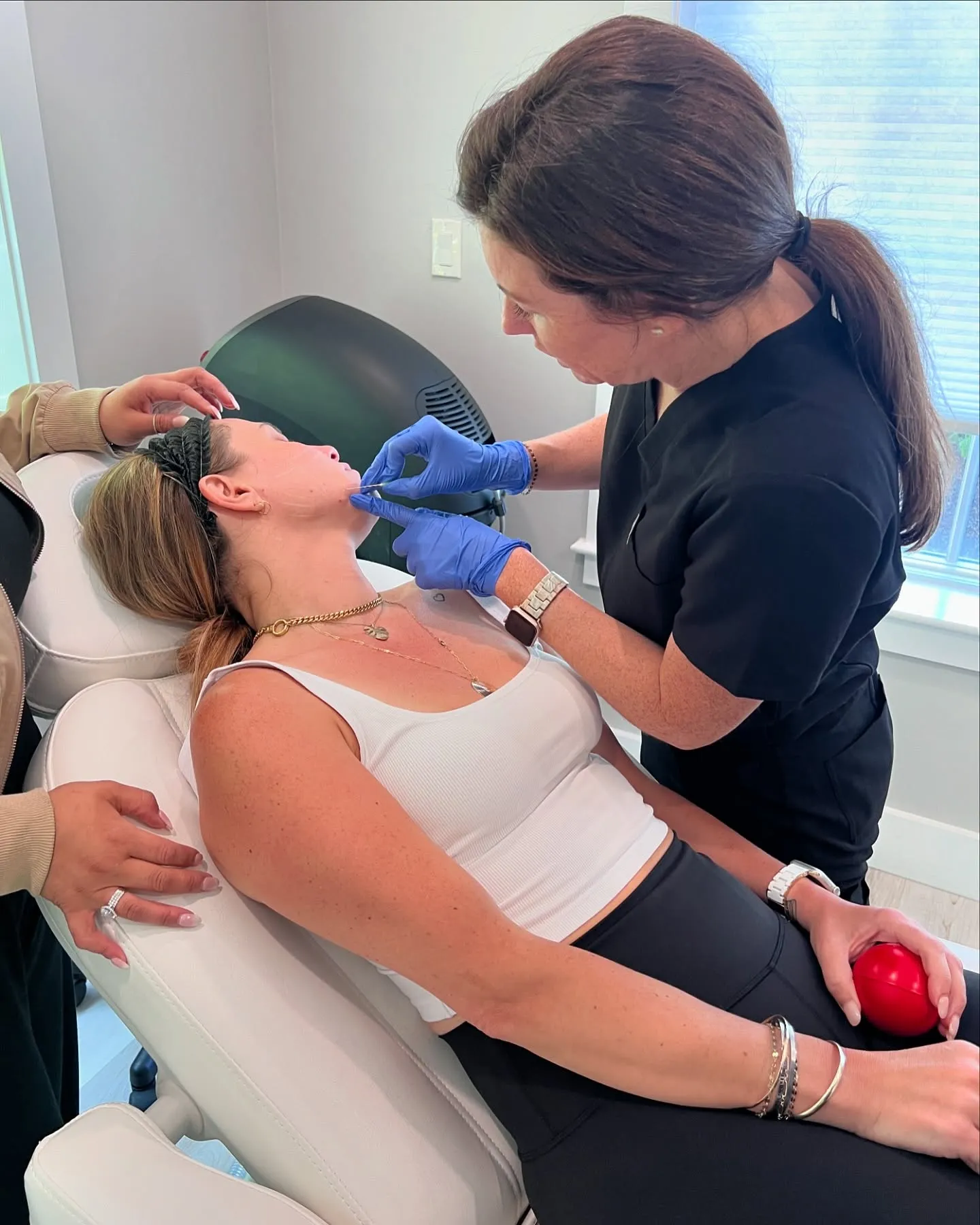 radiesse filler for jawline