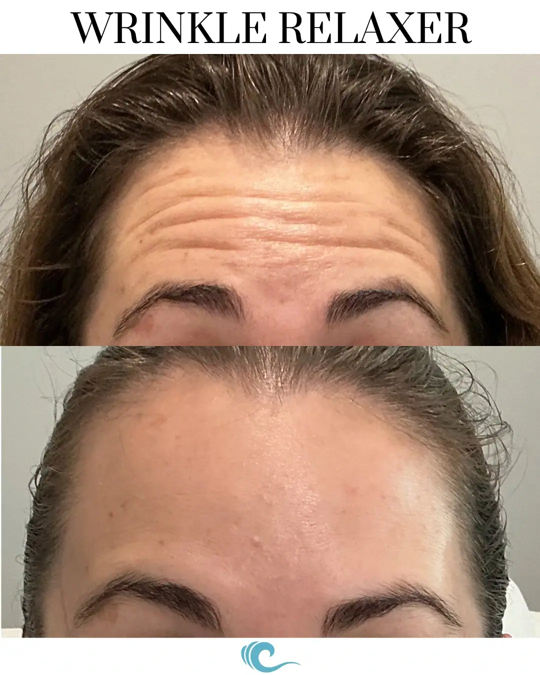 tox maintenance & touch-ups